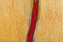 Blood-Line